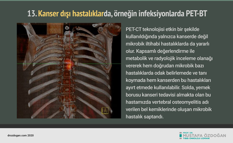 pet bt pozitron emisyon tomografisi nedir tarihcesi (7)