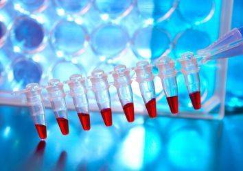 Polimeraz zincir reaksiyonu nedir? PCR tarihçesi, nasıl yapılır ve tıbbi önemi