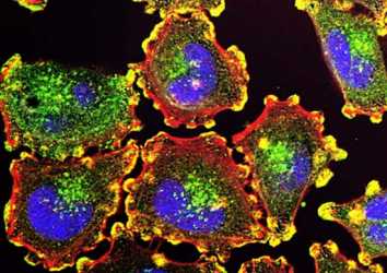 Programlı hücre ölümü (apoptoz) üzerinden kanser tedavisine yeni bir soluk