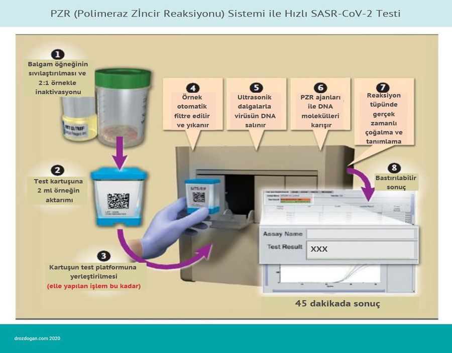 PZR polimeraz zincir reaksiyonu sistemi ile hizli sars cov 2 testi