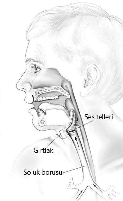 rekrarlayan rekürren solunum yolu laringeal papillomatozis siğil