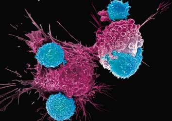 Sarkom tedavisinde HER2 hedefli CAR T hücresel immünoterapi ile iki tam yanıt!