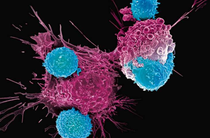 Sarkom tedavisinde HER2 hedefli CAR T hücresel immünoterapi ile iki tam yanıt!