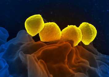 SARS-CoV-2 (yeni koronavirüs) HAVADAN BULAŞIYOR! İşte 10 kanıt