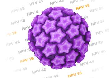 Solunum papillomatozu ve tonsil kanseri – HPV ilişkili iki hasta örneği