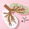 Tedaviye Dirençli EGFR-Mutant Akciğer Kanserinde HER3 Hedefli Patritumab Deruxtecan