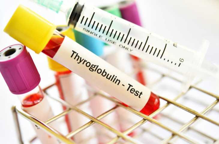 Tiroglobulin ve TgAb Testi Nedir? Yüksekliği Neden Olur? Kanserle İlişkisi