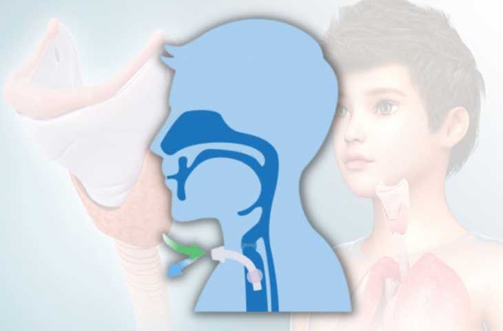 Trakeotomi Nedir? Neden Yapılır, Nereden Açılır, Kalıcı mıdır? Trakeostomiden Farkı