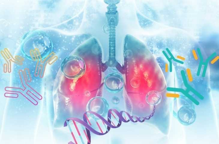 Tümör Mutasyon Yükü, Akciğer Kanserli Hastalarda İmmünoterapi Yanıtını Belirliyor