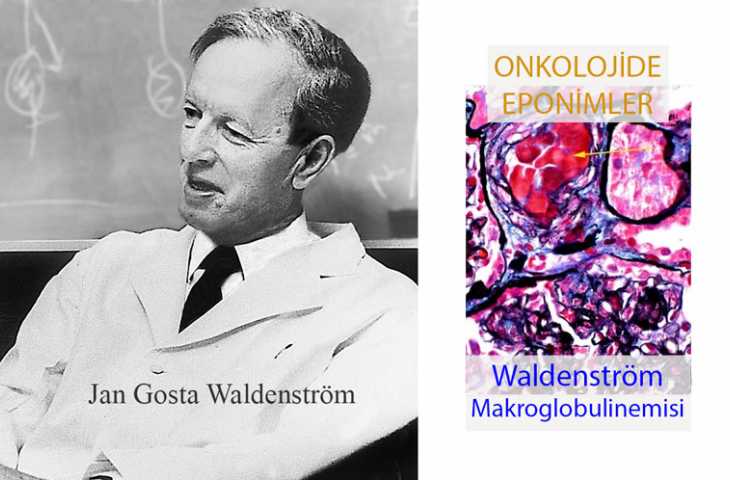 Waldenström Makroglobulinemisi Nedir? İsmi Nereden Gelmektedir?