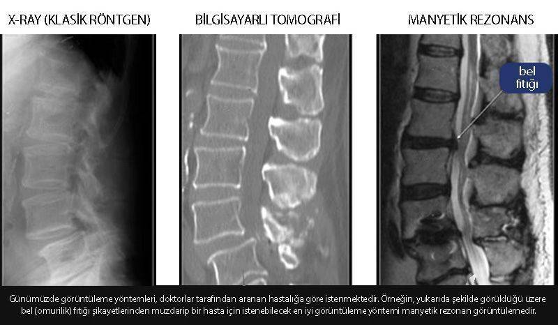 xray röntgen bilgisayarlı tomografi manyetik rezonans karşılaştırması