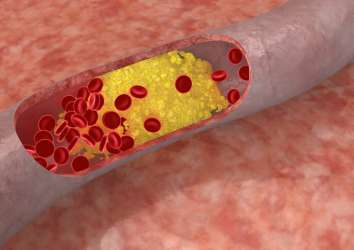 Yaşa göre kolesterol (HDL, LDL, Trigliserid) düzeyleri ne olmalı?